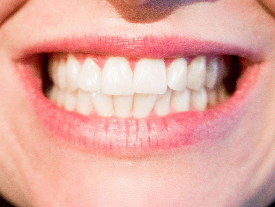 clean smile